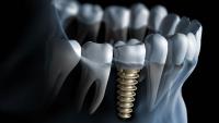 Advanced Dentistry image 4
